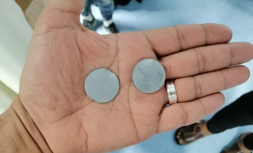 نجاح عملية إخراج قرصين معدنيين من معدة  طفلة بالنج