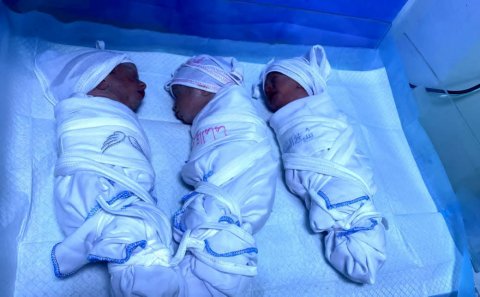بعد 8 سنوات من العقم.. نجاح عملية قيصرية طارئة لولادة توائم ثلاثية في البصرة
